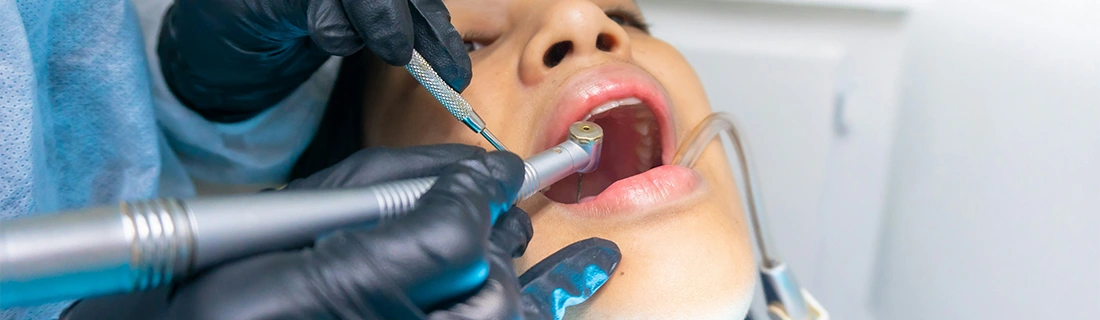 FC – Routine Dental Exams & Cleanings at Kelly Blair DDS in Fort Worth TX